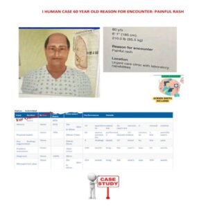 I Human Case Study Week #4 60-Year-Old Male Patient with Painful Rash - - Image 1
